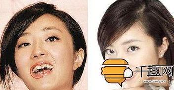 明星烂牙齿,烂牙背后的秘密与应对之道